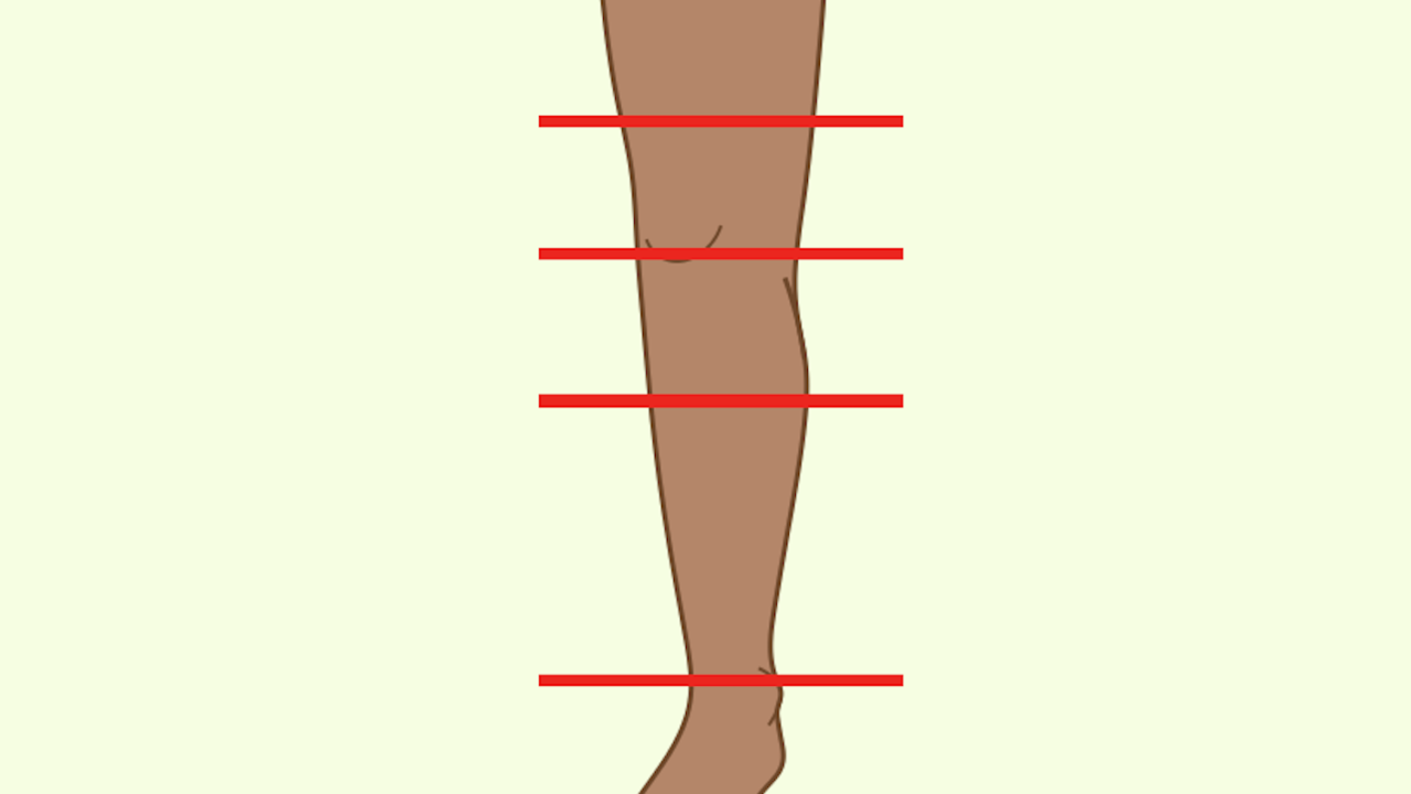 Lower Extremity Amputations