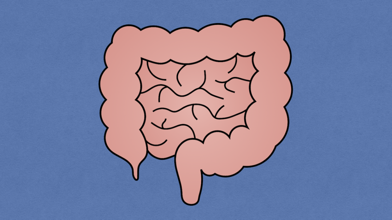 Ileus, postoperative