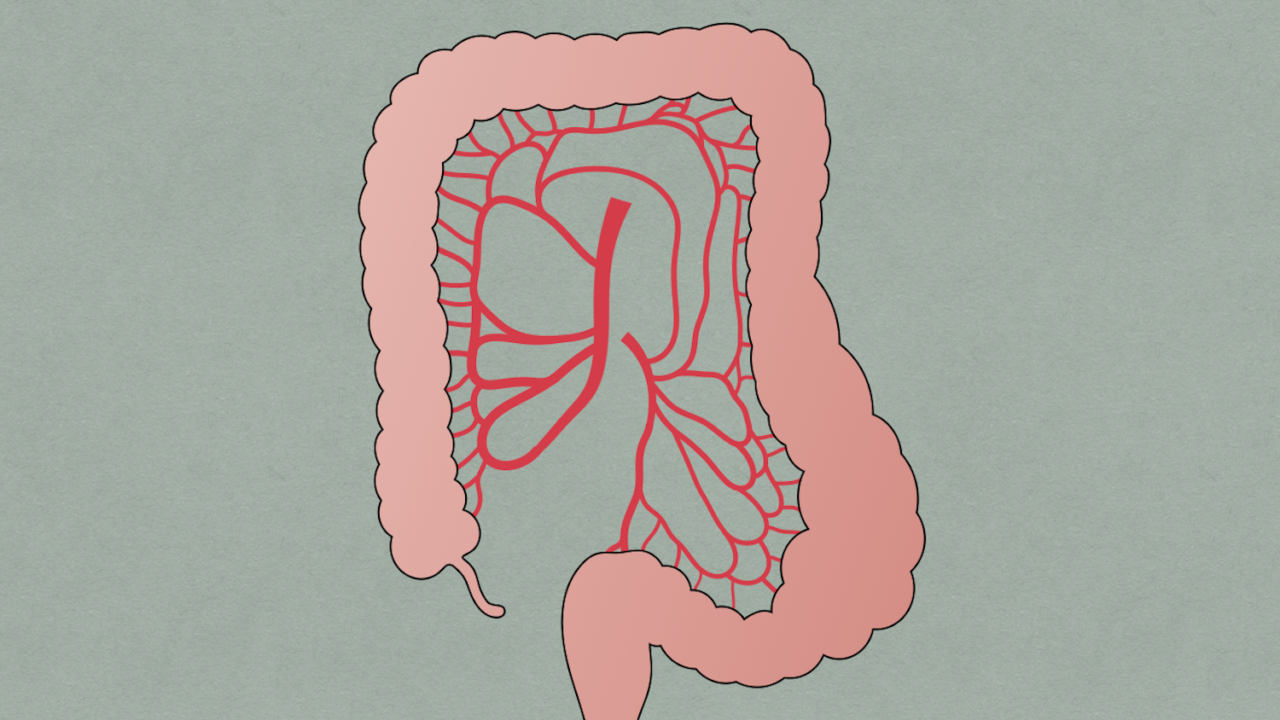 Colonic Pseudo-obstruction