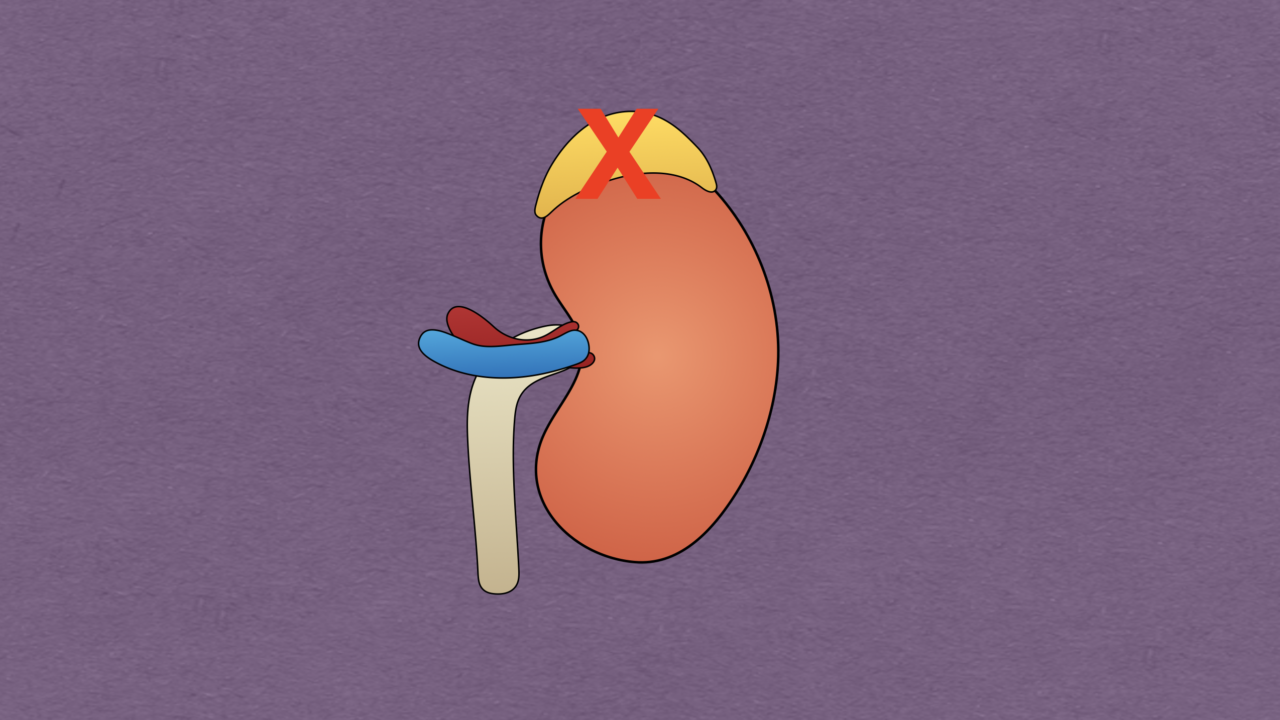 Adrenal Insufficiency