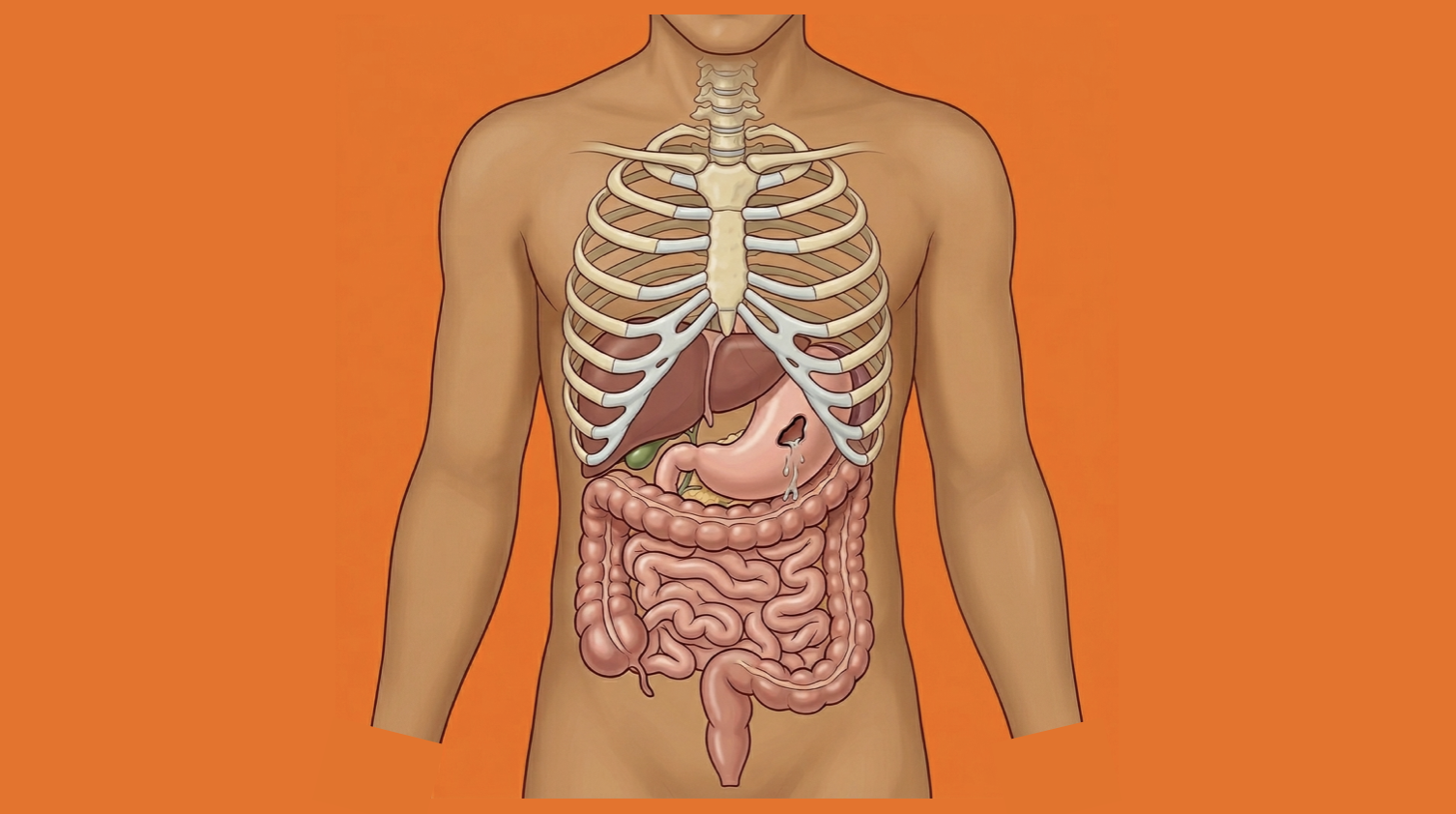 Gastric and Duodenal Perforations