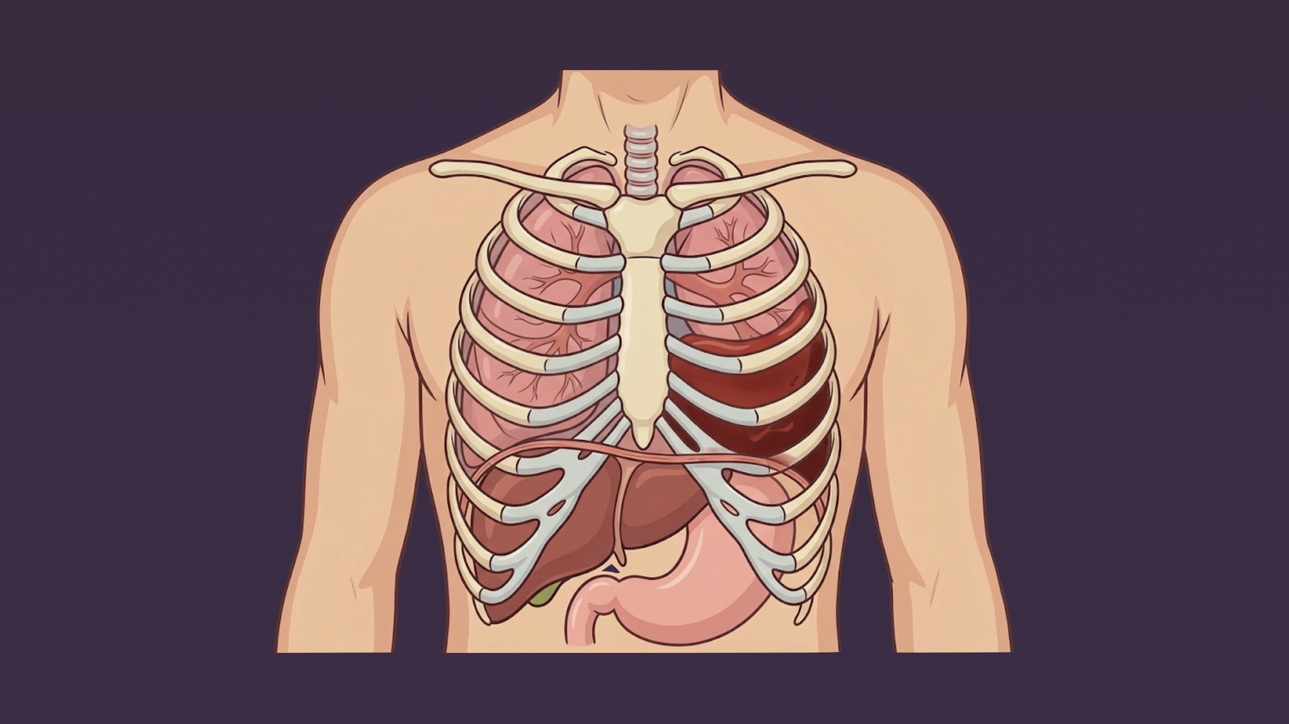 Retained Hemothorax